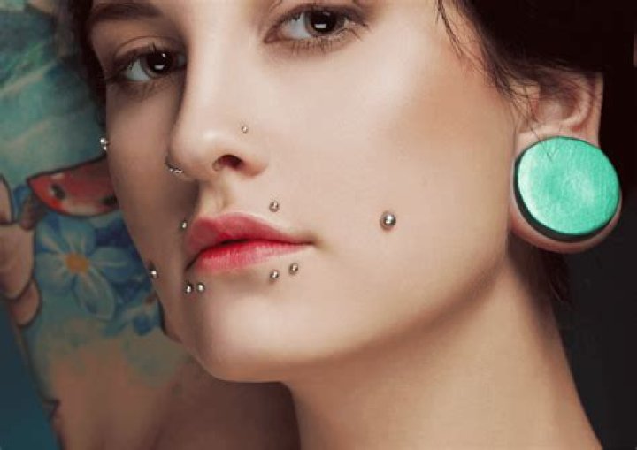 Are dermal anchors permanent?