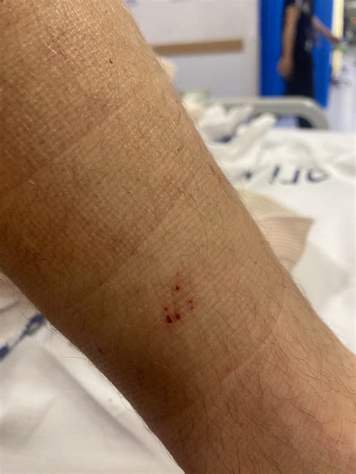 Can a cat survive a brown snake bite?