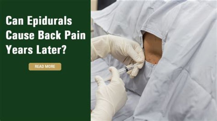 Can epidural cause back pain years later?