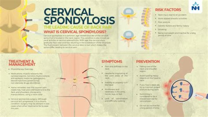 Can spondylosis causes upper back pain?