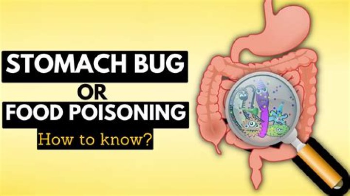 Can you diagnose a stomach bug?