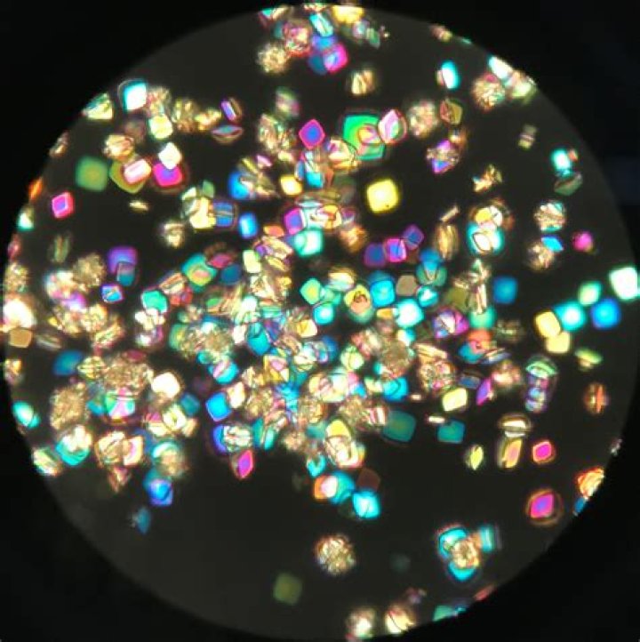 Do uric acid crystals polarize?