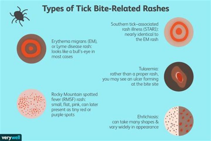Does a tick bite have a bump?