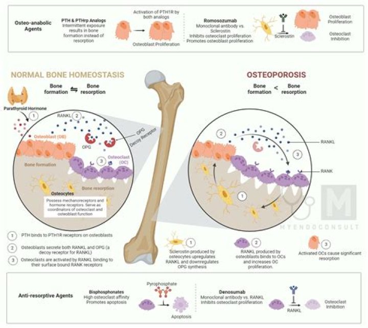 Does alendronate cause bone pain?