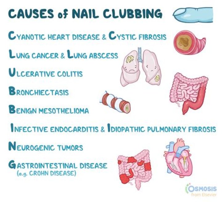 Does seal clubbing still happen?