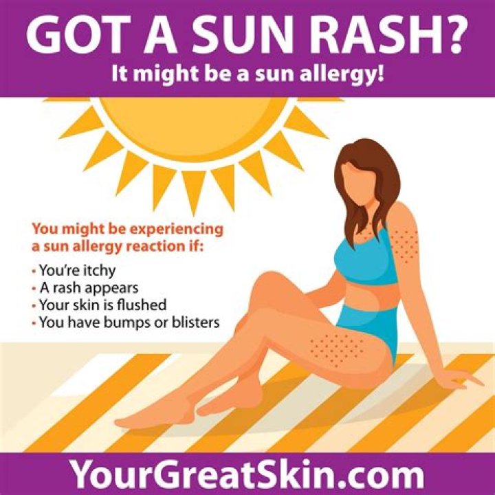 How do you get rid of a sun allergy rash?