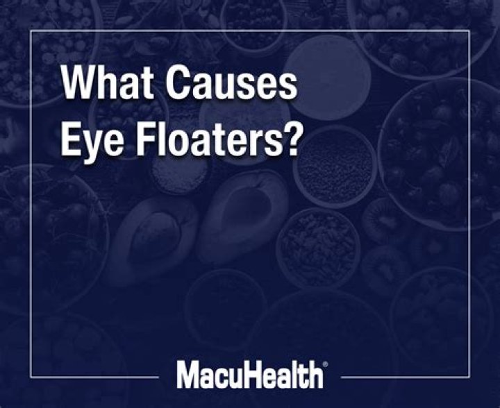 How do you get rid of black eye floaters?