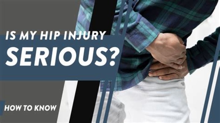 How do you know if a hip injury is serious?