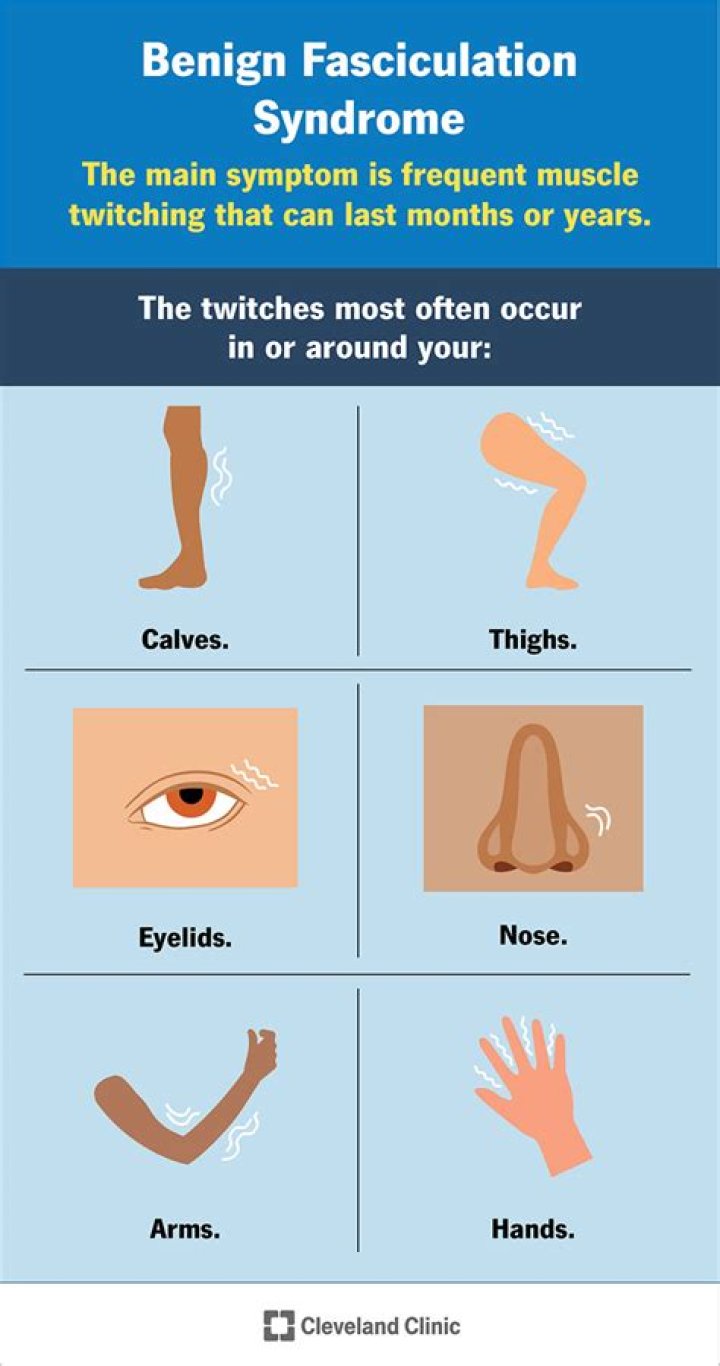 How do you treat fasciculation syndrome cramps?