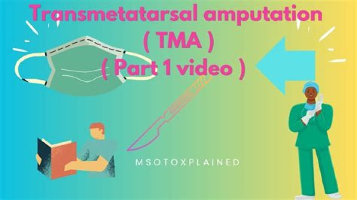 How do you treat TMA?