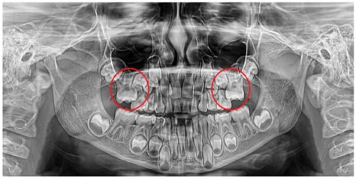 How is Bayardo San Roman described?