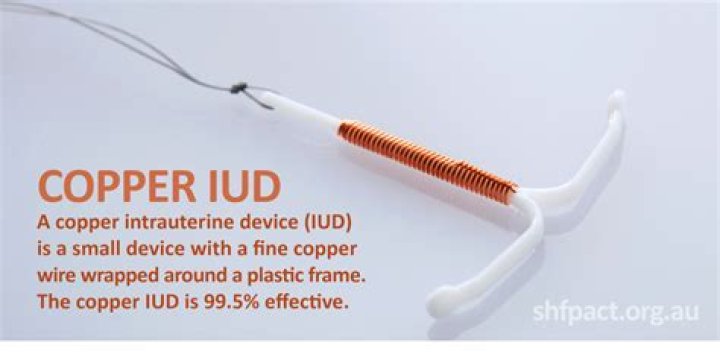 How long does copper IUD last?