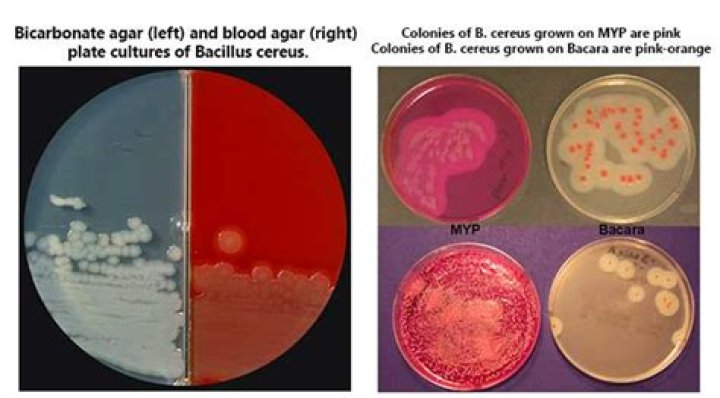 Is Bacillus cereus positive for oxidase?