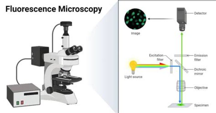 Is fluorescence microscope expensive?