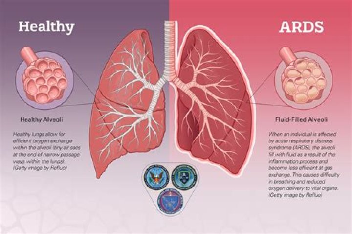 Is ionized air bad for your lungs?
