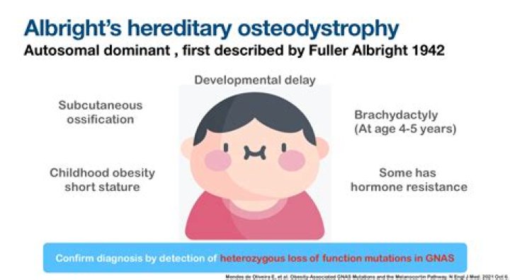 Is short ulna syndrome hereditary?