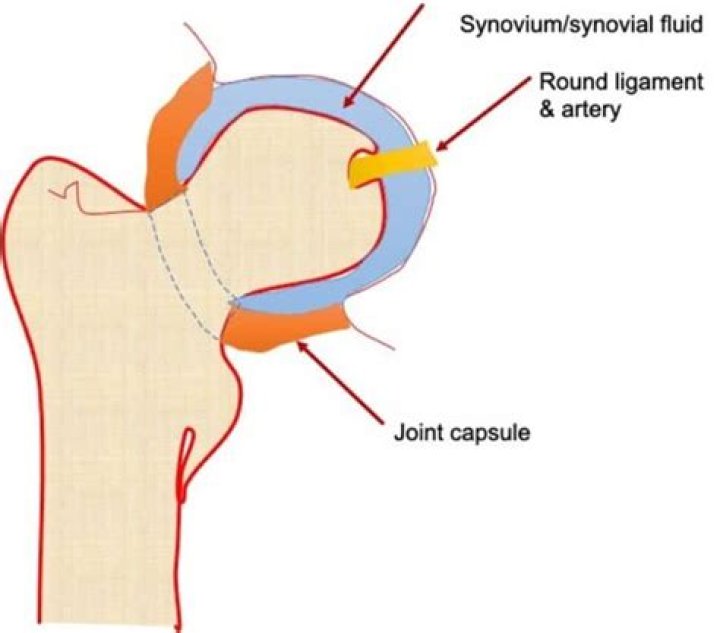 Is there synovial fluid in the hip joint?