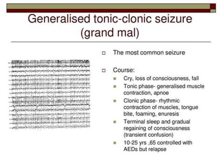 Is tonic-clonic seizure the same as epilepsy?