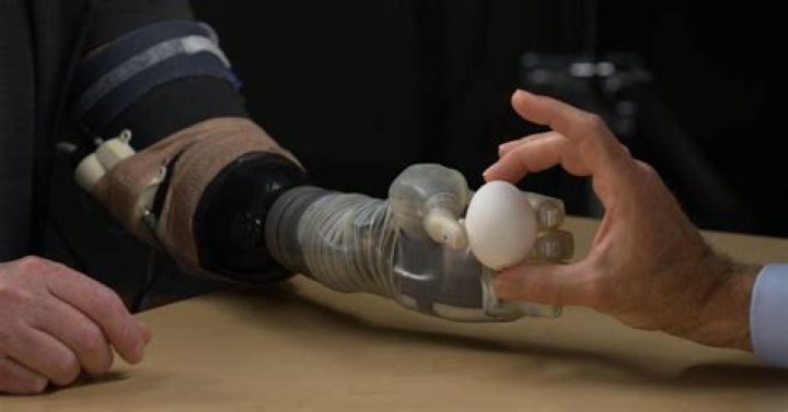 What are new materials and advances being made in prosthetics?