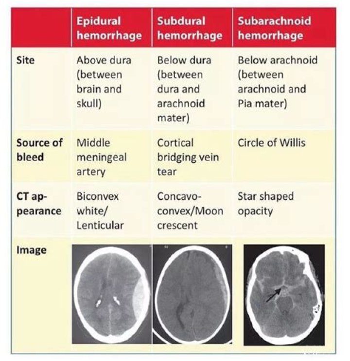 What are the four types of hemorrhage?