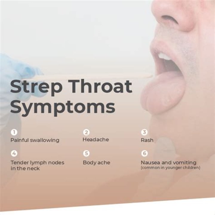 What are the symptoms of Group A strep throat?