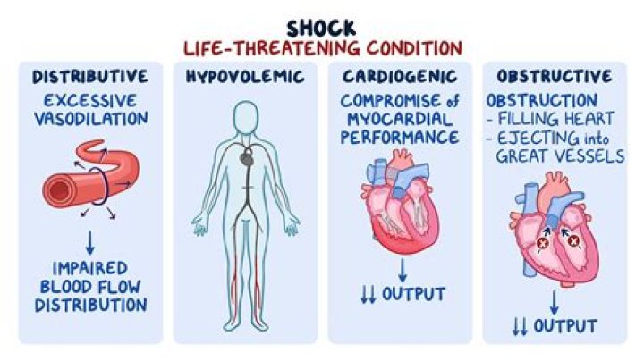 What causes circulatory shock?