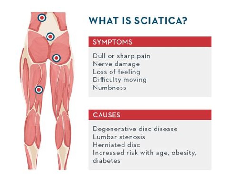 What causes sciatica in both legs?