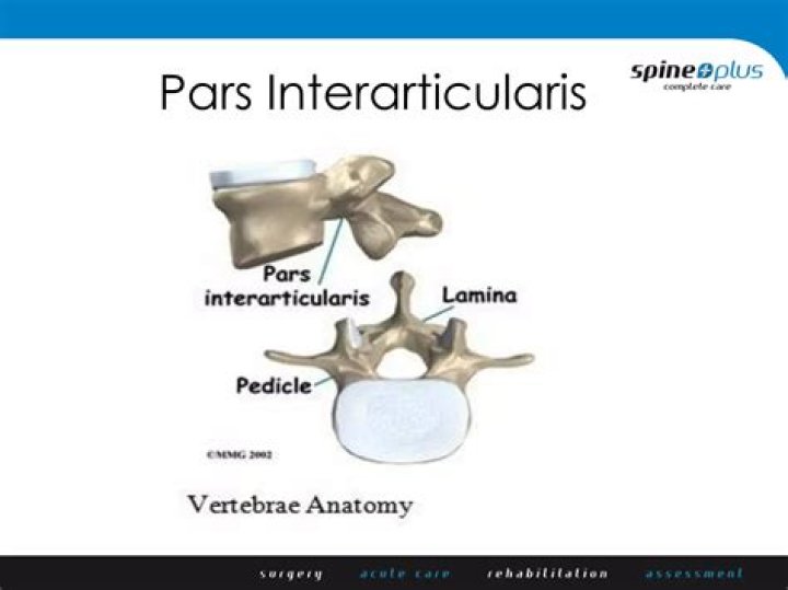 What does pars interarticularis mean?