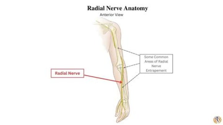 What does radicular mean?