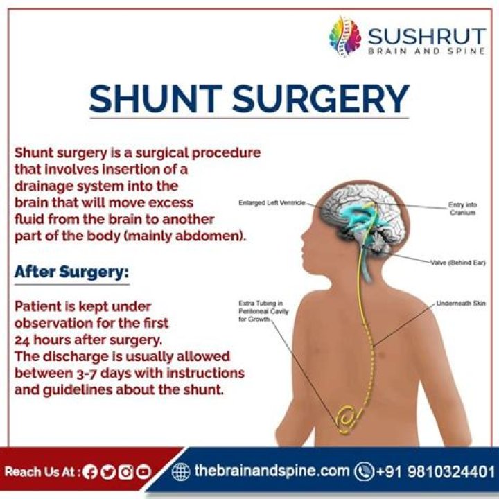 What does shunt mean in medical terms?