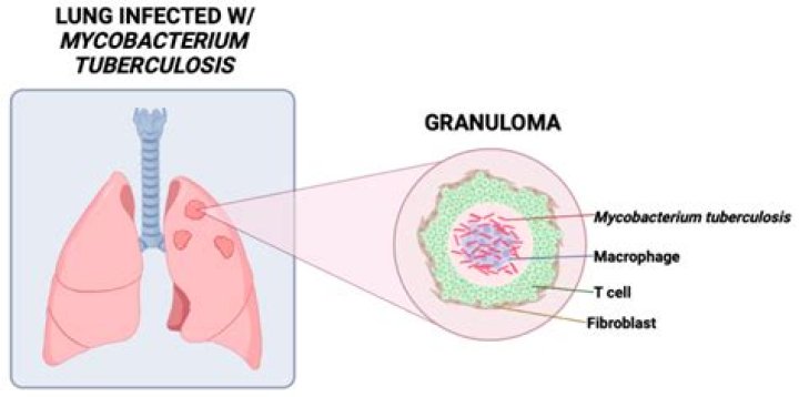 What happened Bovis?