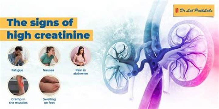 What if your creatinine is high?