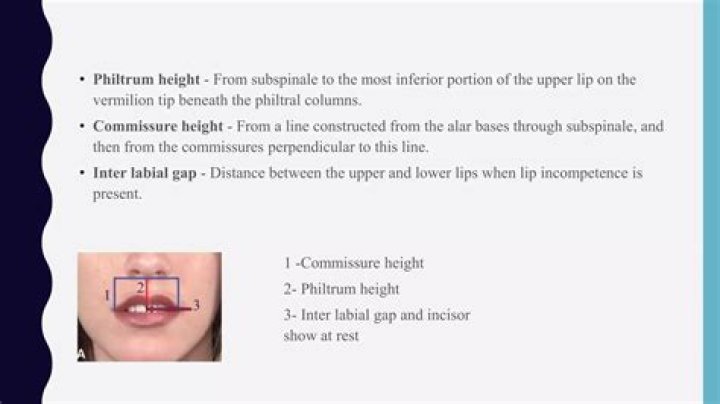 What is commissure height?