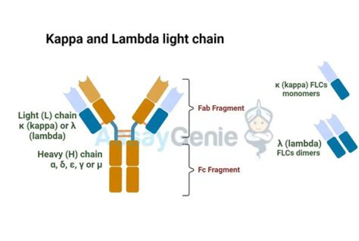 What is considered a high free kappa light chain?