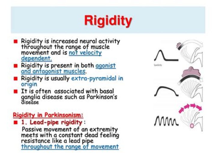 What is hyper rigidity?