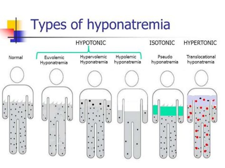 What is hypervolemic hyponatremia?