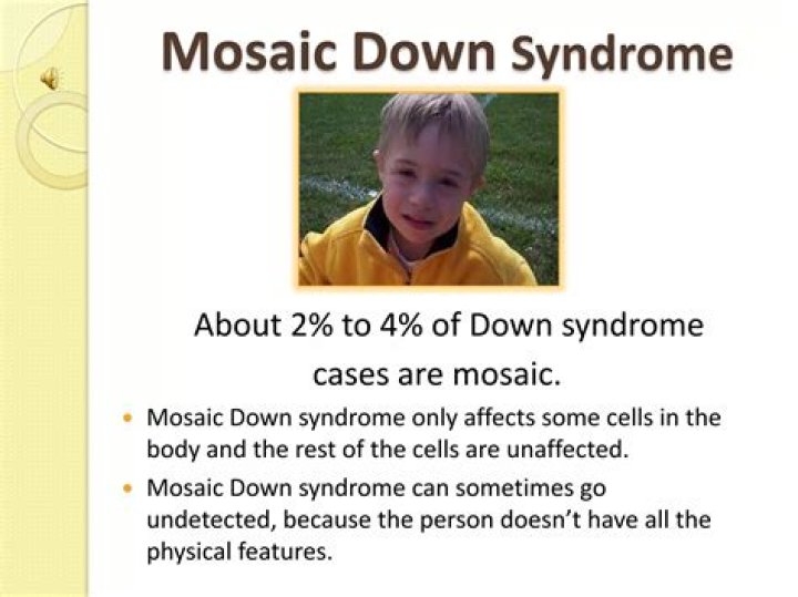 What is mosaic Down syndrome?