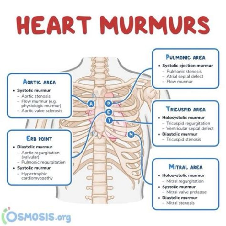 What is S1 and S2 murmur?