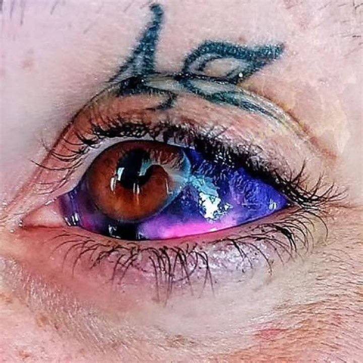 What is the best way to tattoo the cornea?