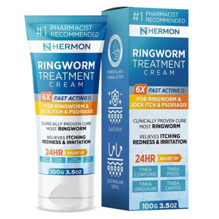 What is the most common treatment that cures ringworm?