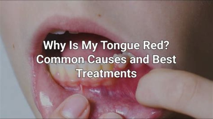 Why is it red around my pubes?